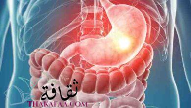 أسباب وطرق علاج ارتجاع المريء والتهاب الحلق أسباب وطرق علاج ارتجاع المريء والتهاب الحلق