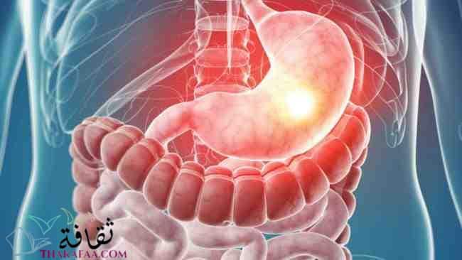 أسباب وطرق علاج ارتجاع المريء والتهاب الحلق