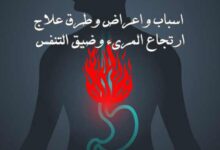 العلاقة بين ارتجاع المريء وضيق التنفس(GERD)-اسبابة و طرق علاجة العلاقة بين ارتجاع المريء وضيق التنفس(GERD)-اسبابة و طرق علاجة