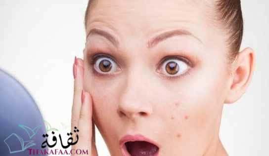 ماسك لازالة الحبوب من اول مرة افضل وصفات و خلطات للوجه ماسك لازالة الحبوب من اول مرة افضل وصفات و خلطات للوجه