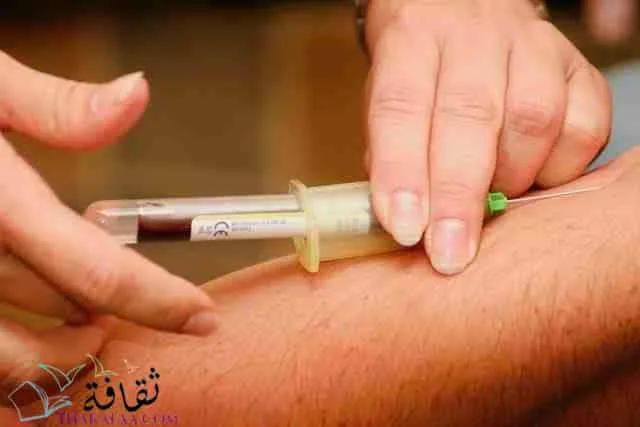 اسباب ارتفاع نسبة البروتين في الدم
