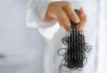 صورة اهم 15 أسباب تساقط الشعر و افضل طرق العلاج و كيفية الوقاية منة