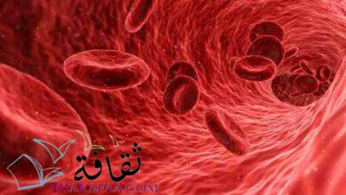 بحث شامل عن نسبة البروتين في الدم و البول أسبابة وأعراضه وطرق الفحص بحث شامل عن نسبة البروتين في الدم و البول أسبابة وأعراضه وطرق الفحص