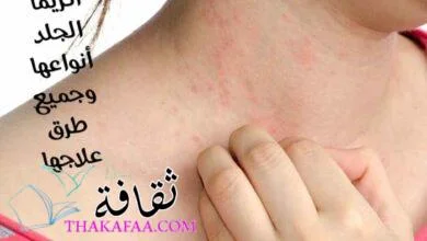 أﻫم المعلومات عن الإكزيما : اكزيما الجلد أنواعها وجميع طرق علاجها