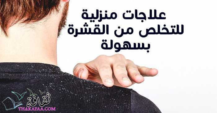 7 علاجات منزلية للقشرة للتخلص من قشرة الرأس بسهولة 2022 7 علاجات منزلية للقشرة للتخلص من قشرة الرأس بسهولة 2022
