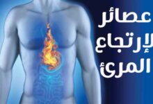 أفضل عصير لإرتجاع المرئ ومشروبات تخفف الحموضة 2022 أفضل عصير لإرتجاع المرئ ومشروبات تخفف الحموضة 2022