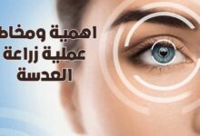 اهمية ومخاطر عملية زراعة العدسة لضعف النظر الشديد 2022 اهمية ومخاطر عملية زراعة العدسة لضعف النظر الشديد 2022