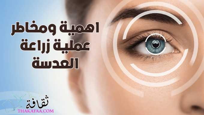 اهمية ومخاطر عملية زراعة العدسة لضعف النظر الشديد 2022 اهمية ومخاطر عملية زراعة العدسة لضعف النظر الشديد 2022
