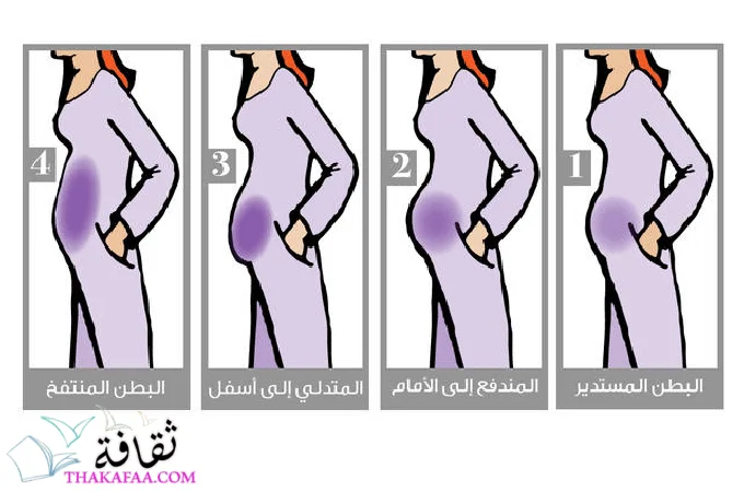 أسباب تراكم الدهون بمنطقة البطن والأرداف