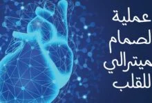 ما هي عملية الصمام الميترالي للقلب؟ وهل هي خطيرة 2023 ما هي عملية الصمام الميترالي للقلب؟ وهل هي خطيرة 2023