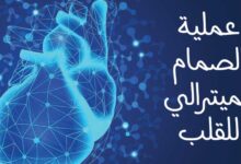 ما هي عملية الصمام الميترالي للقلب؟ وهل هي خطيرة 2023 ما هي عملية الصمام الميترالي للقلب؟ وهل هي خطيرة 2023