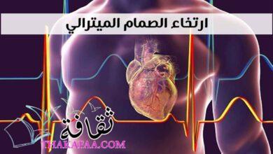 تجربتي مع ارتخاء الصمام الميترالي تجربتي مع ارتخاء الصمام الميترالي
