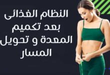 النظام الغذائى بعد تكميم المعدة و تحويل المسار النظام الغذائى بعد تكميم المعدة و تحويل المسار