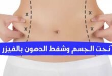 نحت الجسم وشفط الدهون بالفيزر مع الدكتور وائل غانم نحت الجسم وشفط الدهون بالفيزر مع الدكتور وائل غانم