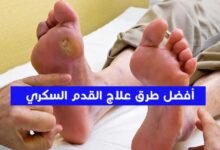 ما هى أفضل طرق علاج القدم السكري؟ ما هى أفضل طرق علاج القدم السكري؟