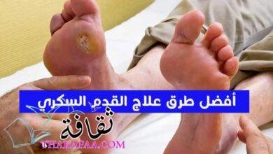 ما هى أفضل طرق علاج القدم السكري؟ ما هى أفضل طرق علاج القدم السكري؟