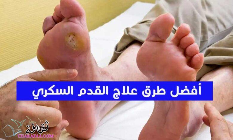 ما هى أفضل طرق علاج القدم السكري؟ ما هى أفضل طرق علاج القدم السكري؟