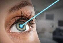 كيفية جراحة العيون باستخدام ليزك؟