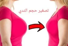 عملية تصغير حجم الثدي مع الدكتور أحمد الشريفة عملية تصغير حجم الثدي مع الدكتور أحمد الشريفة