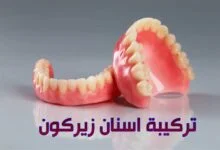 تركيبة اسنان زيركون في اسطنبول في مركز إيلورا كلينك