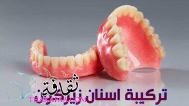 تركيبة اسنان زيركون في اسطنبول في مركز إيلورا كلينك تركيبة اسنان زيركون في اسطنبول في مركز إيلورا كلينك