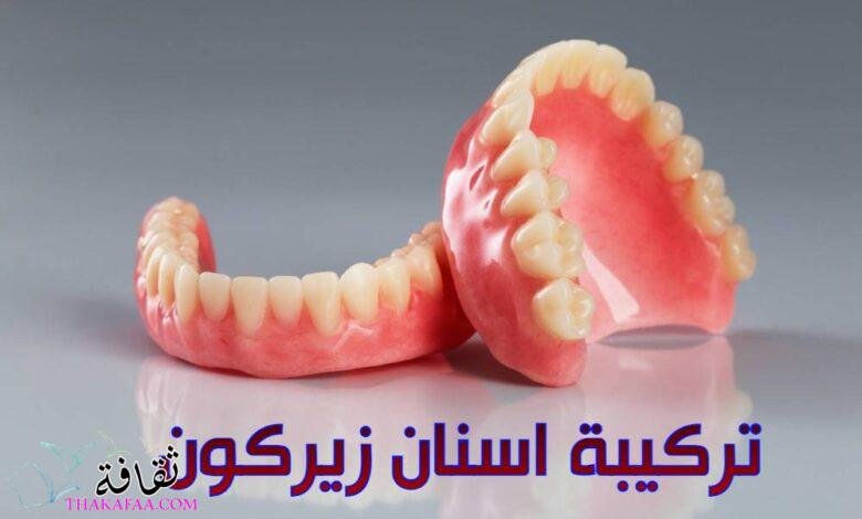 تركيبة اسنان زيركون في اسطنبول في مركز إيلورا كلينك تركيبة اسنان زيركون في اسطنبول في مركز إيلورا كلينك