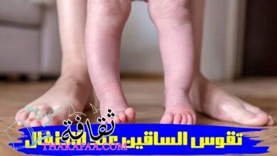 هل يوجد علاج لتقوس الساقين عند الاطفال؟- دكتور ابراهيم حنتيرة 