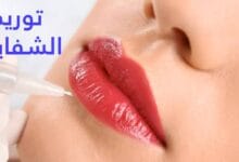 احصل علي أفضل عروض عمليات توريد الشفايف بالليزر في أفضل عيادات التجميل. احصل علي أفضل عروض عمليات توريد الشفايف بالليزر في أفضل عيادات التجميل.
