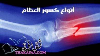 أنواع كسور العظام وأهم طرق العلاج والوقاية أنواع كسور العظام وأهم طرق العلاج والوقاية